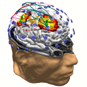 Neuroscan - EEG ERP EP